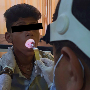 Dr Puneet ENT & Voice Surgeon